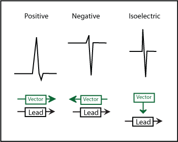 McGill EKG Learning Project