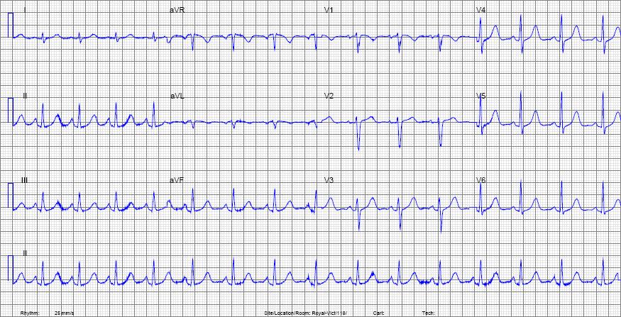 nsr example