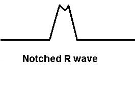 notched R