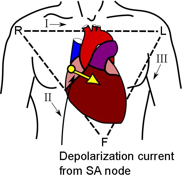 sinus P-waves