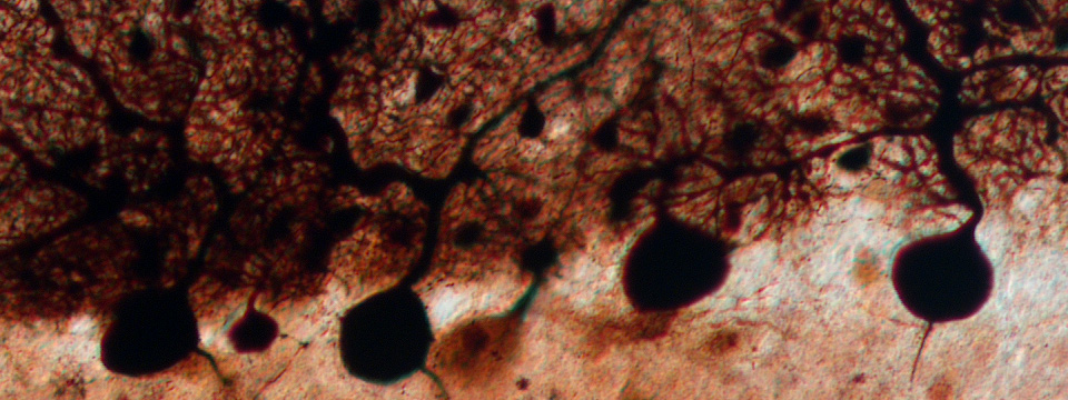 cerebellum cerebellum