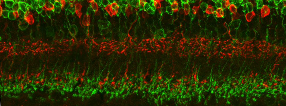 retinastain