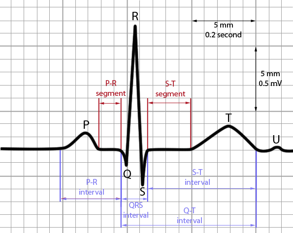 electrocardiogram( ecg worksheet answer key