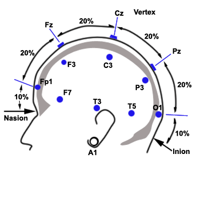 Eeg Placement Chart