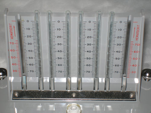 ESR (Erytrorocyte Sedimentation rate)