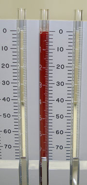 What is the importance of a sedimentation rate blood test?