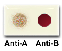 Blood Cell Indices Blood Typing The Abo System